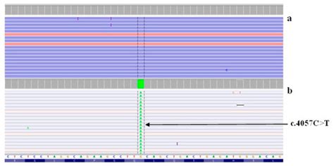 Spectrum of Genes for Non-GJB2-Related Non-Syndromic Hearing Loss in ...