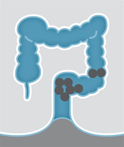 Constipation and Diarrhea - Gastroenterology Of The Rockies