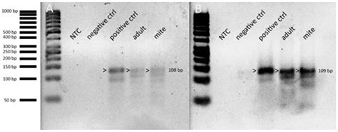 Metagenomic Approach with the NetoVIR Enrichment Protocol Reveals Virus ...