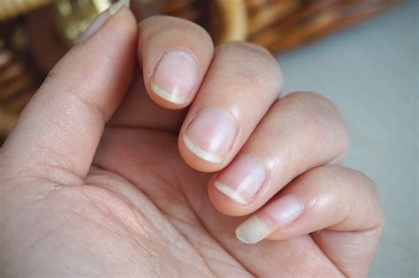 指甲的形状带来的暗示是什么-手指甲的表象都暗示身体出了什么问题？