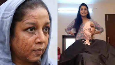 Shilpa Navalkar reveals the efforts she makes to show burnt marks on ...