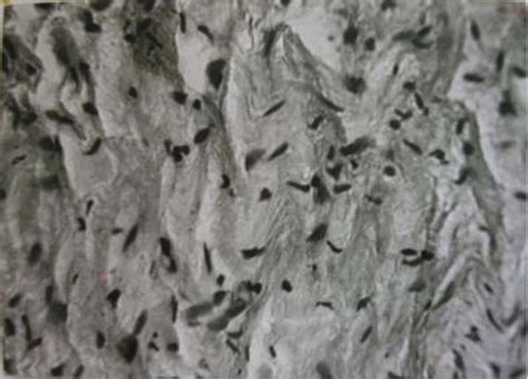 Spindle Shape 的图像结果