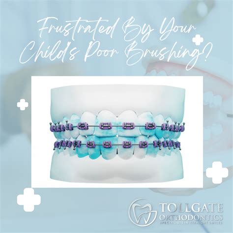 My Child Isn't Really Cleaning When They Brush! | Tollgate O