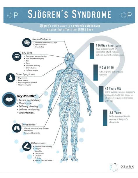 Types Of Sjogrens Syndrome