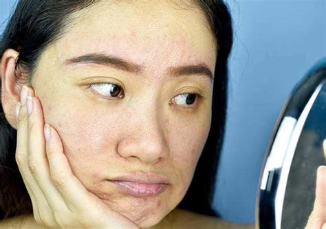 8 Papaya Face Packs That Benefits Your Skin | Femina.in