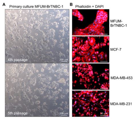 MFUM-BrTNBC-1, a Newly Established Patient-Derived Triple-Negative ...