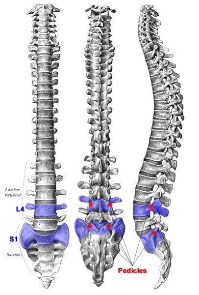 Strong Bones - Congenital Scoliosis