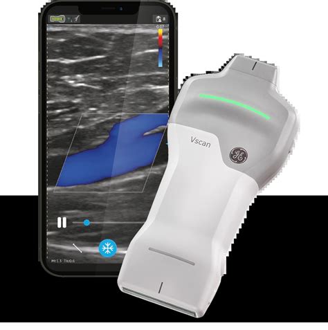 Wireless handheld cardiac & vascular ultrasound | Vscan Air™ SL
