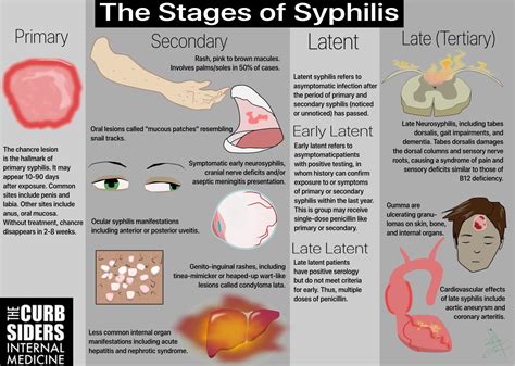 The Stages of Syphilis Primary Syphilis - The chancre lesion is the