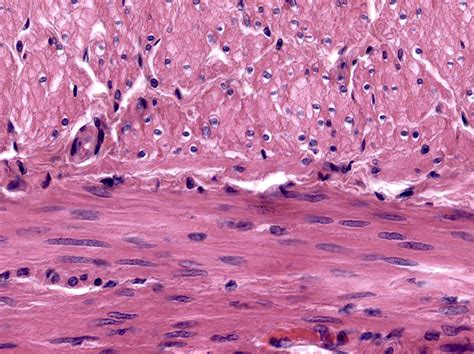 Trachea Microscope Slide Smooth Muscle