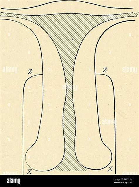 . The Principles and practice of gynecology : for students and practitioners. variety of causes ...
