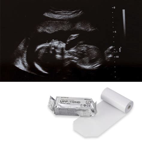 Maximize Print Quality with Sony Medical Print Media - Sony Pro