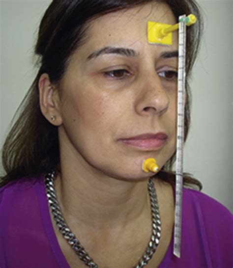 A procedure for directly measuring the physiologic rest position and ...