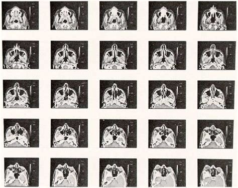 Computer Surgery 的图像结果