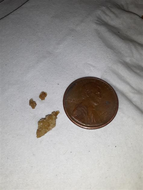 11.8 mm kidney stone that I pissed out... : r/MakeMeSuffer