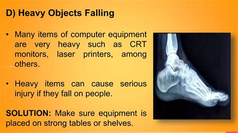 Defects of Using Prolonged ICT Tools 的图像结果
