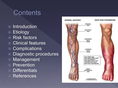 Image result for DVT Algorithm Nice