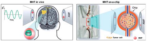 Magnetic Hyperthermia for Cancer Treatment: Main Parameters Affecting ...
