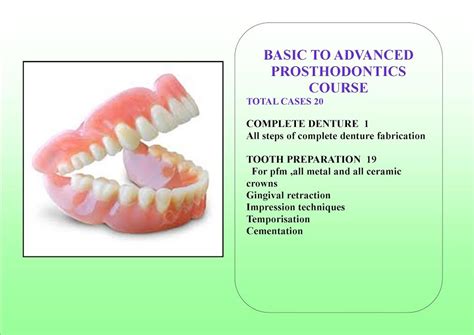 Prosthodontics Course in Delhi - Delhi Dental Academy