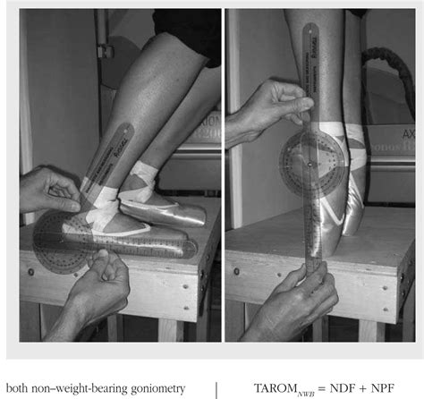 Goniometric measurement of ankle range of motion in weight