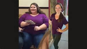 Weight loss story: Woman with rare disease, Calciphylaxis, sheds over ...