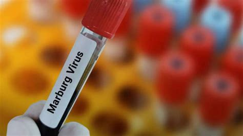 15 People Die Of Marburg Virus Disease, 63 Infected In Rwanda; Check ...