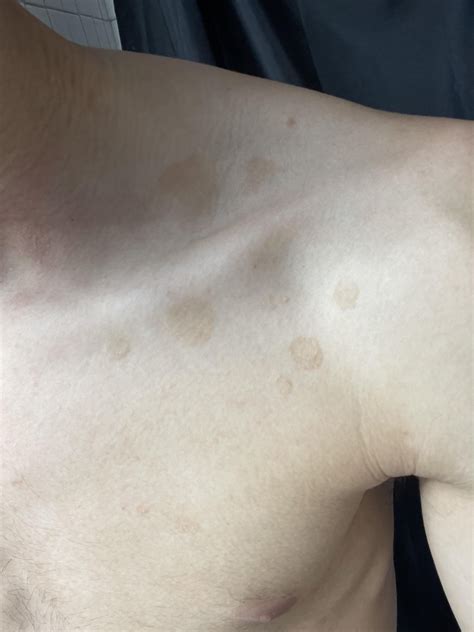 EXTREME, sudden lower back pain : r/AskDoctorSmeeee