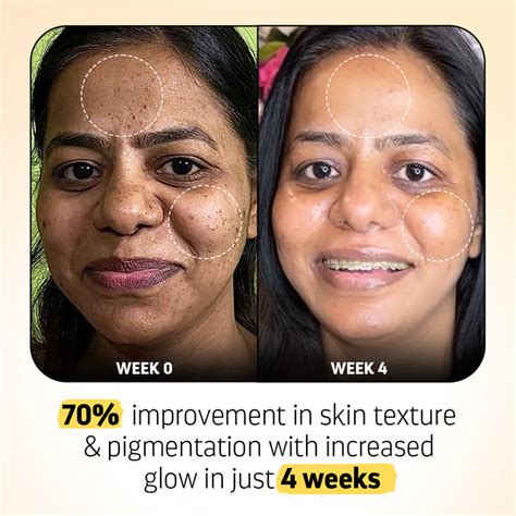 Luxury Skincare Products | Indulgeo Essentials | Advanced Skincare