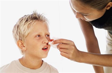 孩子经常流鼻血，是怎么回事？ - 知乎