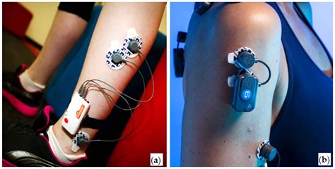 What Is EMG (Electromyography) And How Does It Work?, 55% OFF