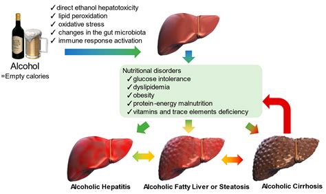 Liver Cirrhosis Alcohol