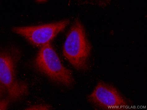 Galectin-1 antibody (CL594-60223) | Proteintech