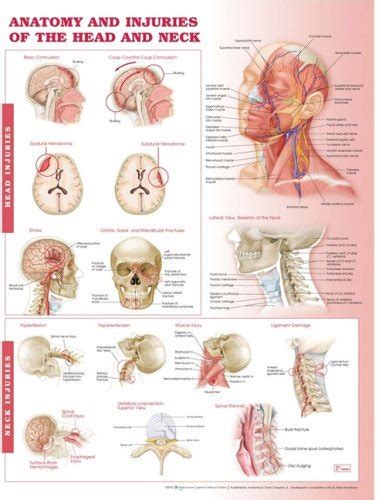 Buy Anatomy and Injuries of The Head and Neck Anatomical Chart Online ...