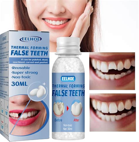 How To Make A Homemade Temporary Tooth Filling at Scott Mendel blog