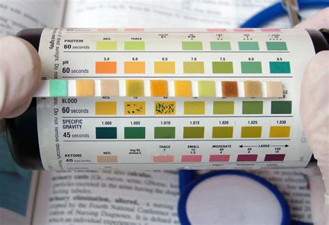 Urine Ph Test Results at Abby Thorn blog