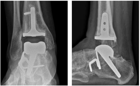 Hardware Monitor Driver 的图像结果