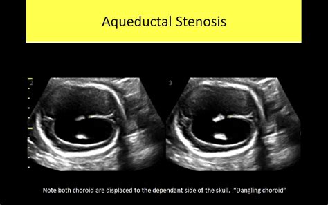 OB GYN Ultrasound Registry Review
