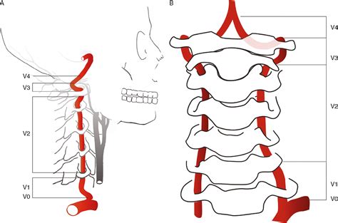 Vertebral Artery Segments