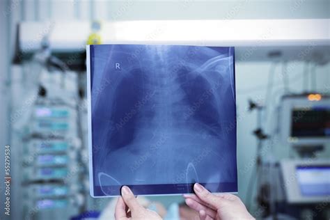 Hospital X-ray Chest 的图像结果
