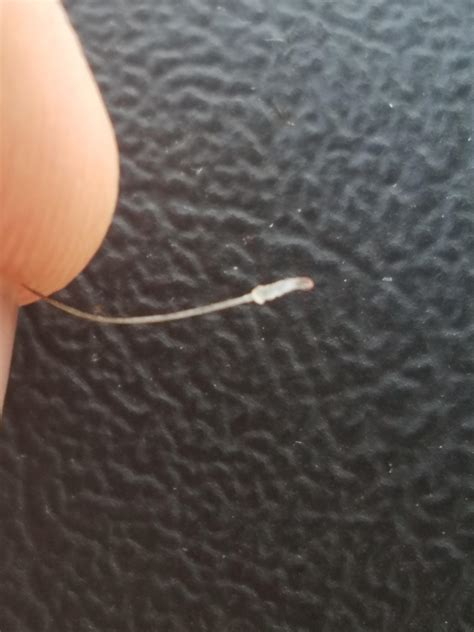 Infected Hair Follicle Pulled Out