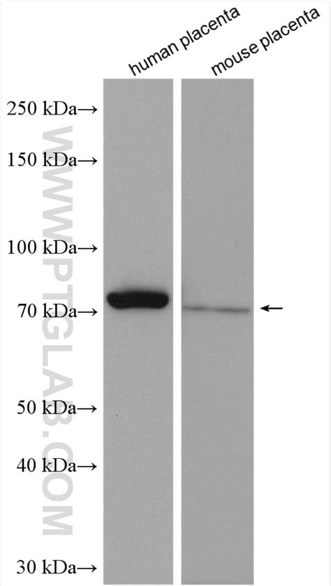 Calpain 6 antibody (10120-1-AP) | Proteintech