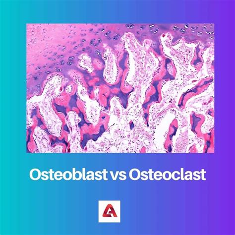 Osteoblast vs Osteoclast: Difference and Comparison
