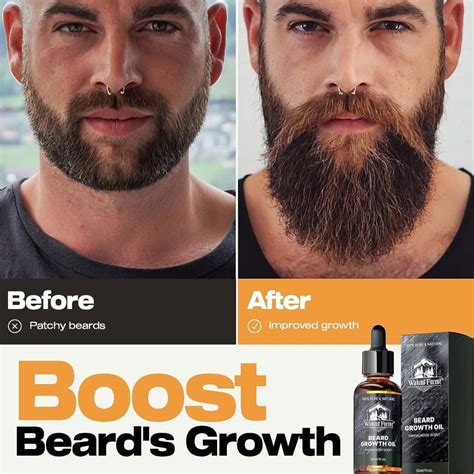 6 Beard Growth Oil Products for a Thicker Beard