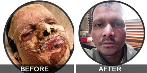 Aggarwal Hospital-Our Treatment History