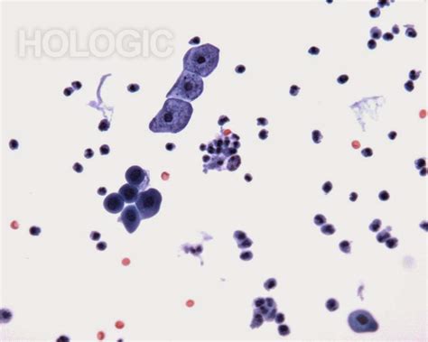 Bildergebnis für candida paragusa