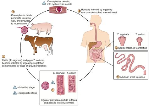 Taenia solium, Taenia asiatica, and Taenia saginata : Taeniasis and Cysticercosis - Clinical Tree
