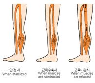 Medrent Hospital Instruments Services - limb therapy system