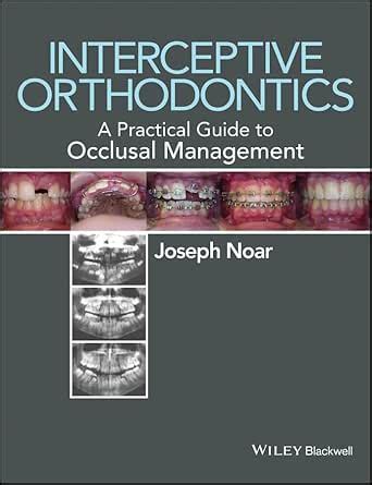 Interceptive Orthodontics: A Practical Guide to Occlusal Management ...