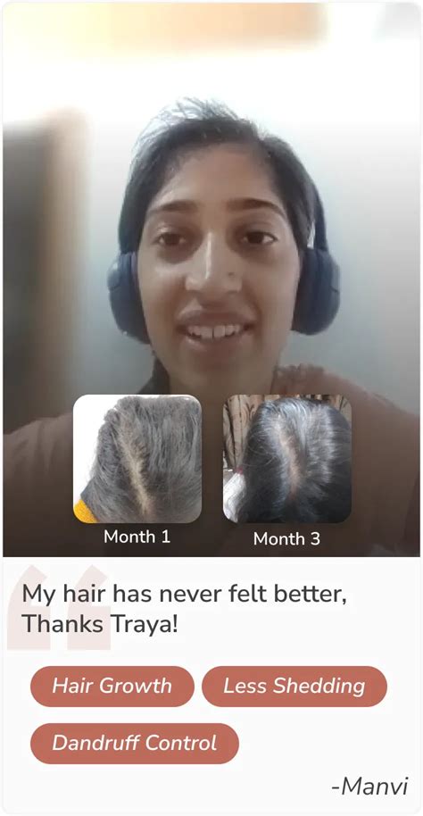 Hair Loss Treatment for Women - Holistic Hair fall Solutions for ...