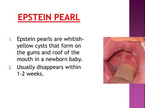 Common neonatal problems | PPTX